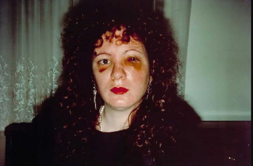 Nan, one month after being battered de Nan Goldin